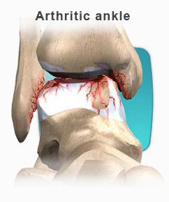 ankle conti anatomy01