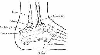 Calcaneal1