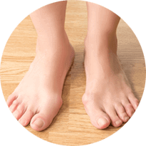 Bunions/Hammertoes Removal, Surgery & Alternatives, Treatment & Recovery Issaquah, WA 98027