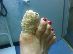 Had unexpected toe surgery today. Owie! by TheGirlsNY, on Flickr