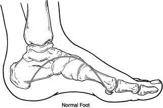 normalfoot