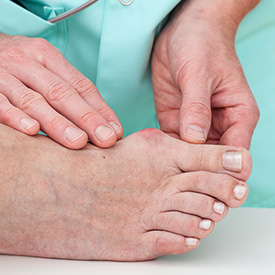 Issaquah Podiatrist's Special Services - Bunions