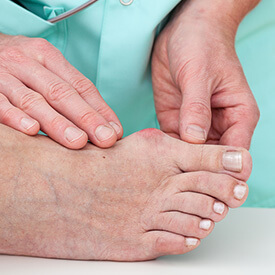 Issaquah Podiatrist's Special Services - Bunions