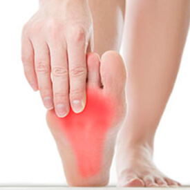 Issaquah Podiatrist's Special Services - Plantar Fasciitis Treatment