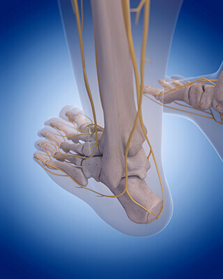 tarsal tunnel syndrome diagram