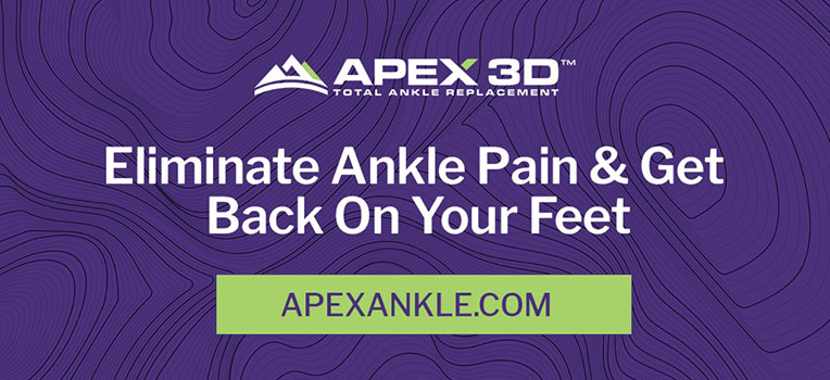 total ankle replacement banner