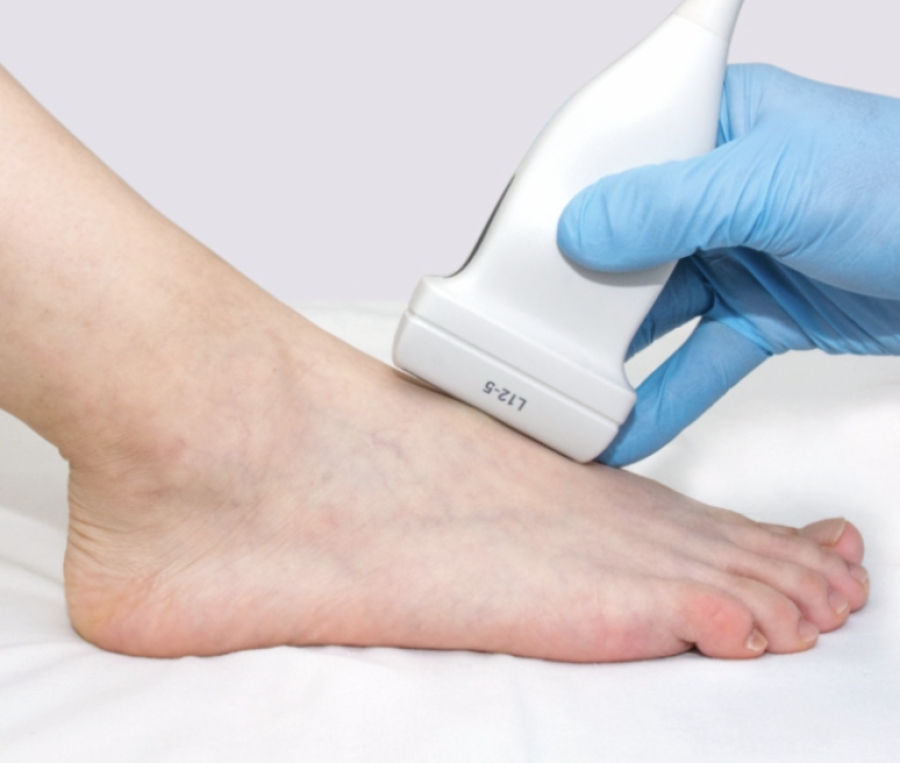 Dr. Timothy Young, a Board-Certified Foot Surgeon, Discusses Evaluation of Bone Healing Status 