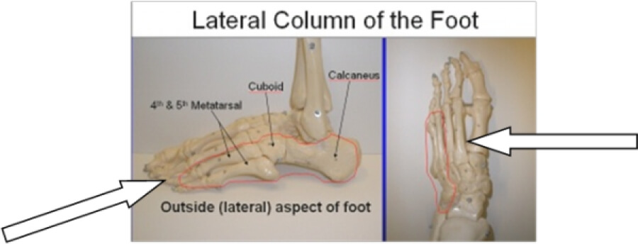 What Causes Hip Pain?  MASS4D® Insoles - MASS4D® Foot Orthotics