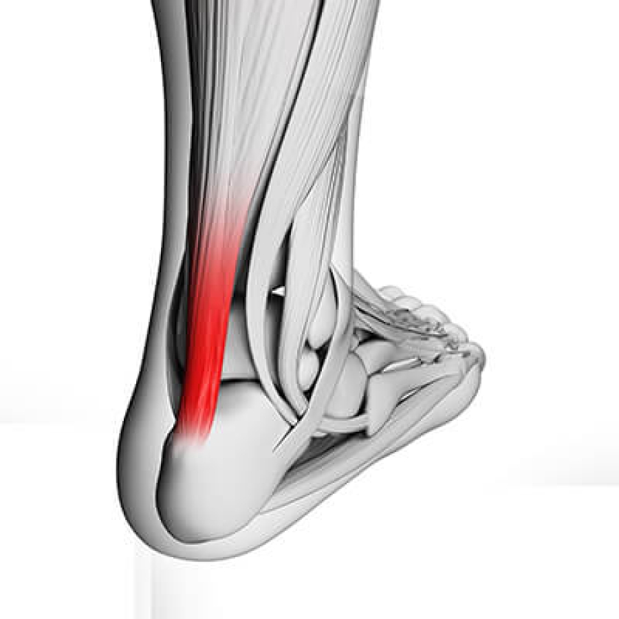 Dr. Timothy Young Discusses Shockwave Therapy for Achilles Tendonitis: A Promising Treatment Option