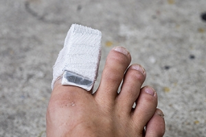 How Long Does a Broken Toe Take To Heal?