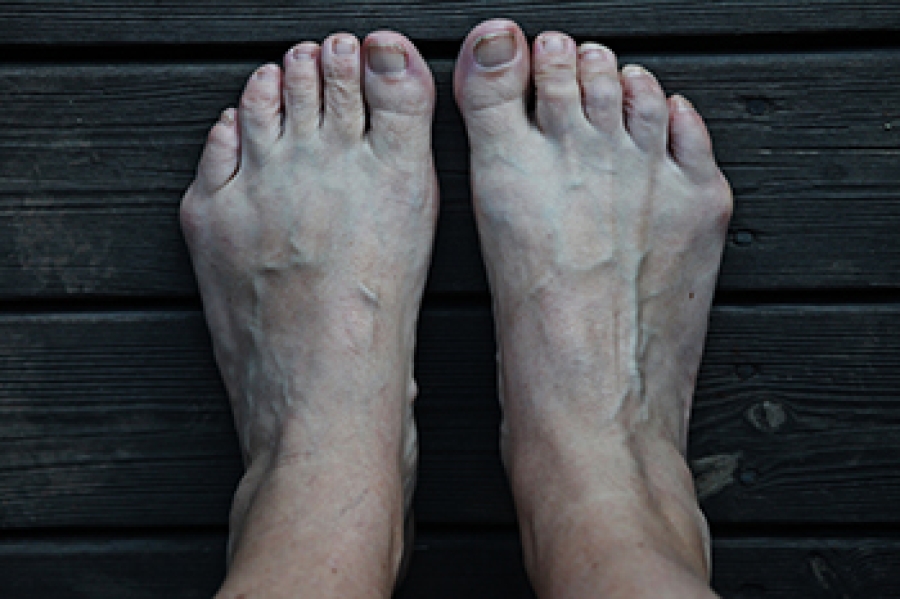 Best shoes deals for bunions 219