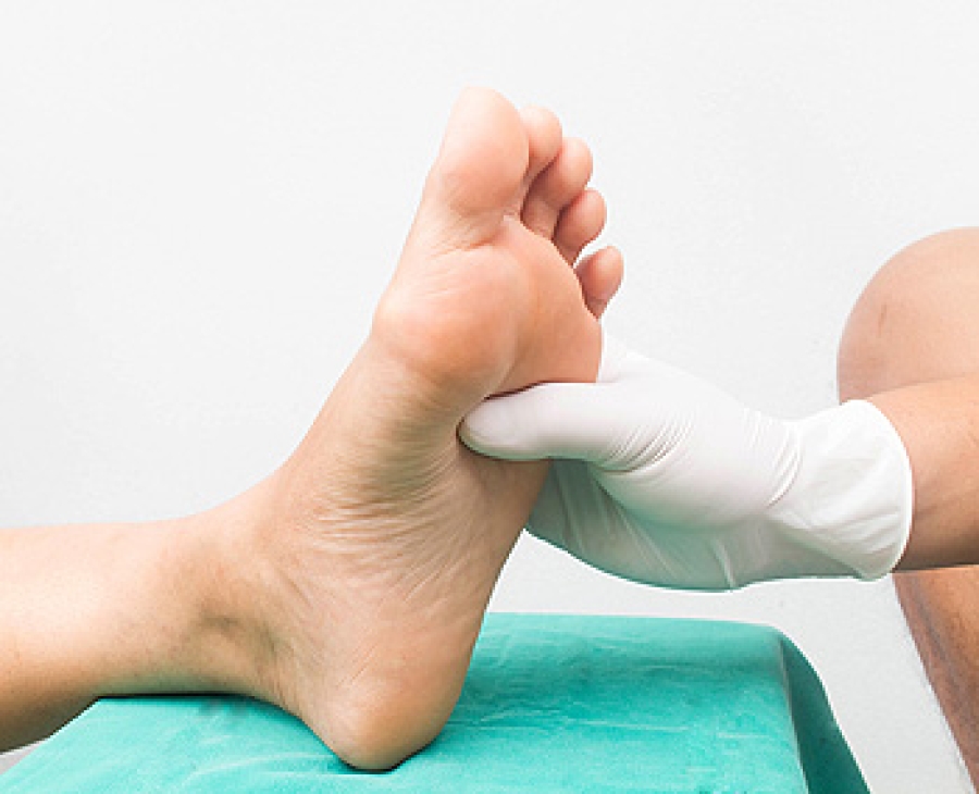 How Diabetes Affects the Feet