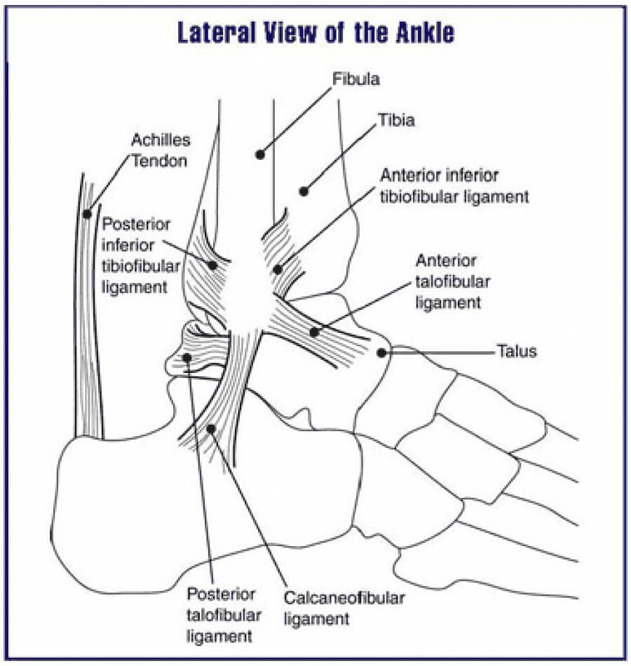 Achilles Tendonitis and Pain in the Morning