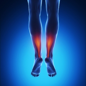 What to Expect During Achilles Tendon Surgery Recovery