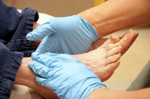 How to Take Care of Your Feet When You Have Diabetes